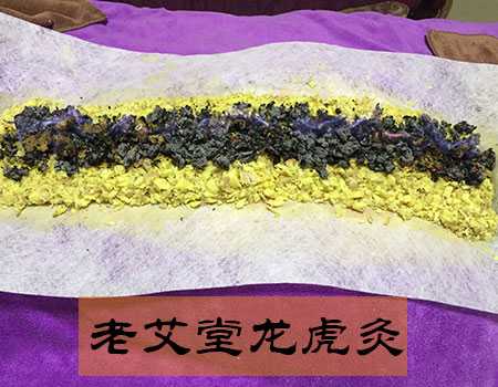 老艾堂三伏灸 老艾堂三伏灸