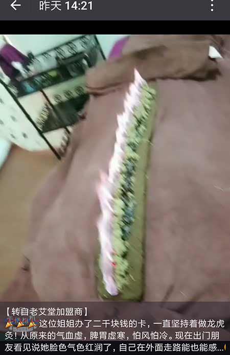 老艾堂龙虎灸调理脾胃
