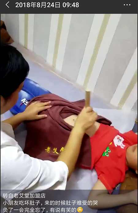 老艾堂艾灸调理小孩秋季肠胃疾病