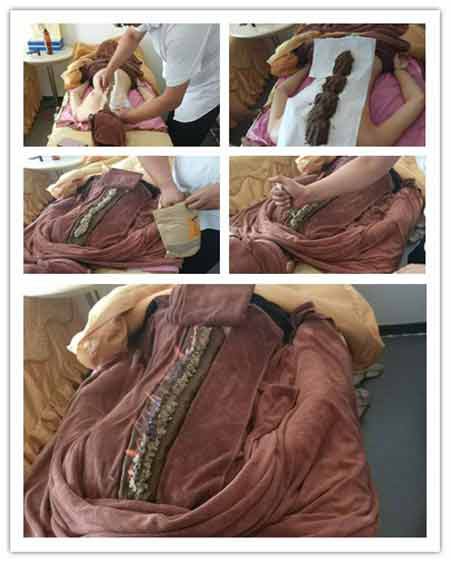 老艾堂龙虎灸操作过程